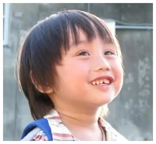 小小彬2岁出道挣钱,亲爸买豪宅后妈整容,皮肤溃烂却得不到医治

