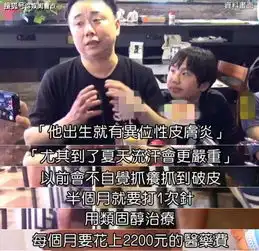 2岁出道身家1800万,被亲爸后妈挥霍完,小小彬13岁长残皮肤溃烂
