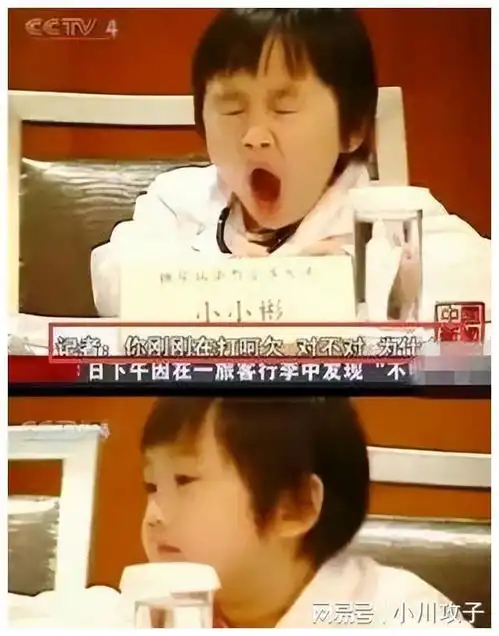 小小彬2岁出道,亲爸买豪宅后妈整容,皮肤溃烂亲爸却不给医治
