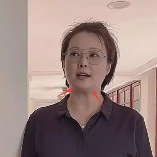  51岁袁立罕露面疑飙至150斤,腿部满是疤痕,细节可见婚姻情况