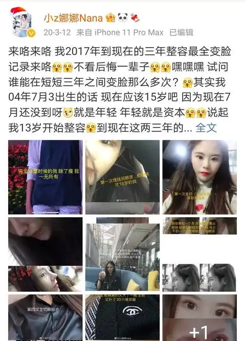  13岁开始整容15岁变蛇精脸,渴望变成虞书欣,就为了博取流量赚钱