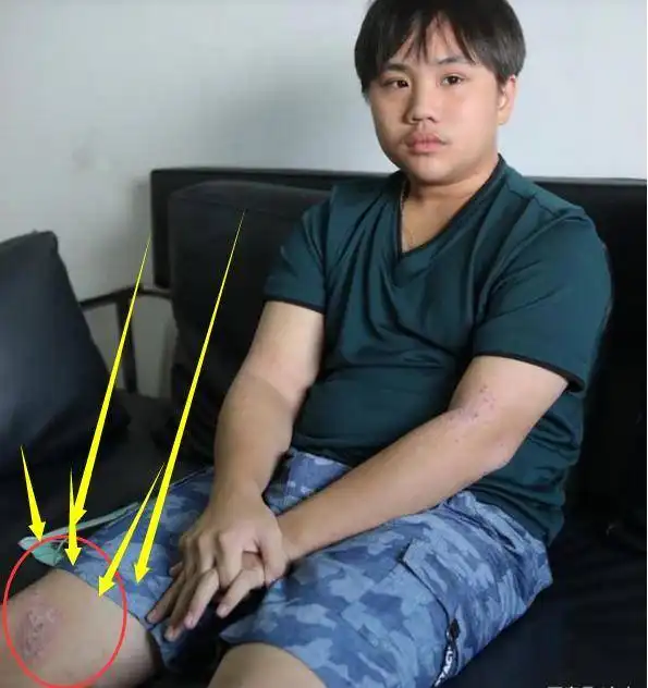  2岁被出道挣钱,今17岁小小彬被曝得病不得治,父亲3婚娶越南新娘