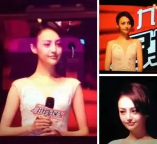  杨幂郑爽柳岩图揭女星整容前后反差大