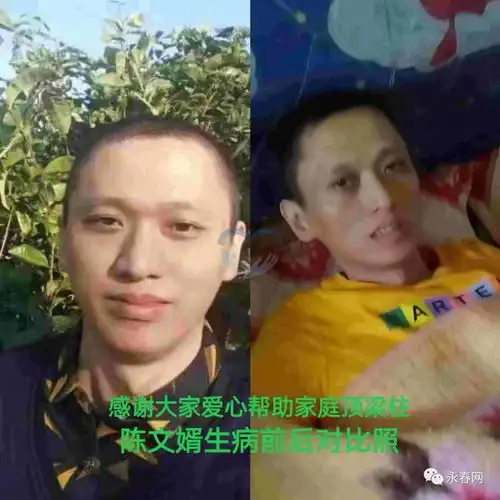  帮帮他永春41岁男子不幸身患肝癌家中还有两个孩子在读书,医疗费学费告急,妻子发帖求助