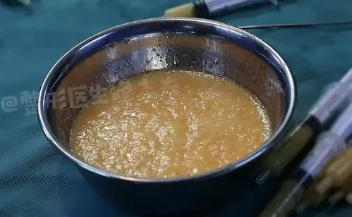  不长胖的方法,帮你安排的明明白白了