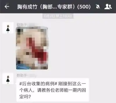  女司机在杭州惨遭车祸,胸部撕裂直见肺部没想到救她命的是微信群